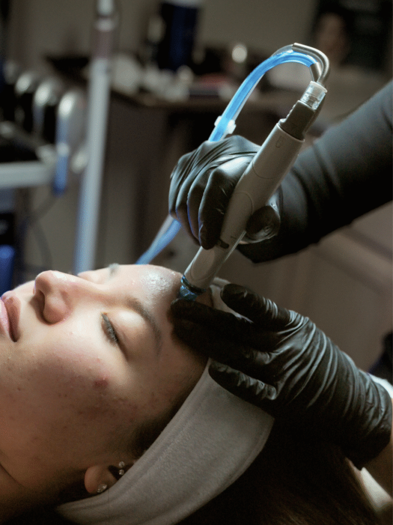 hydra facial