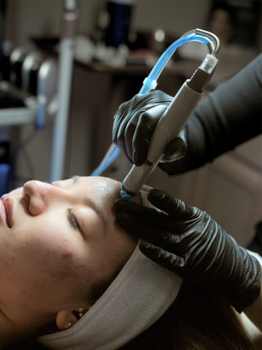 hydra facial