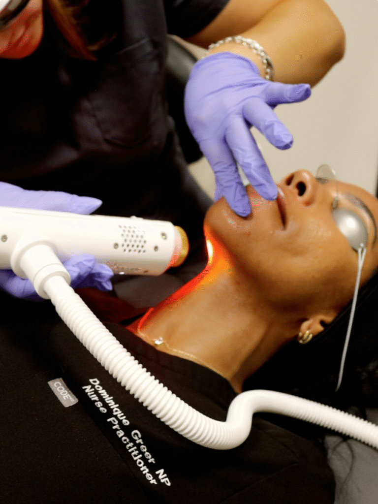 aerolase neo elite laser facial