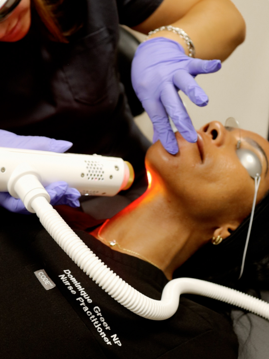 aerolase neo elite laser facial