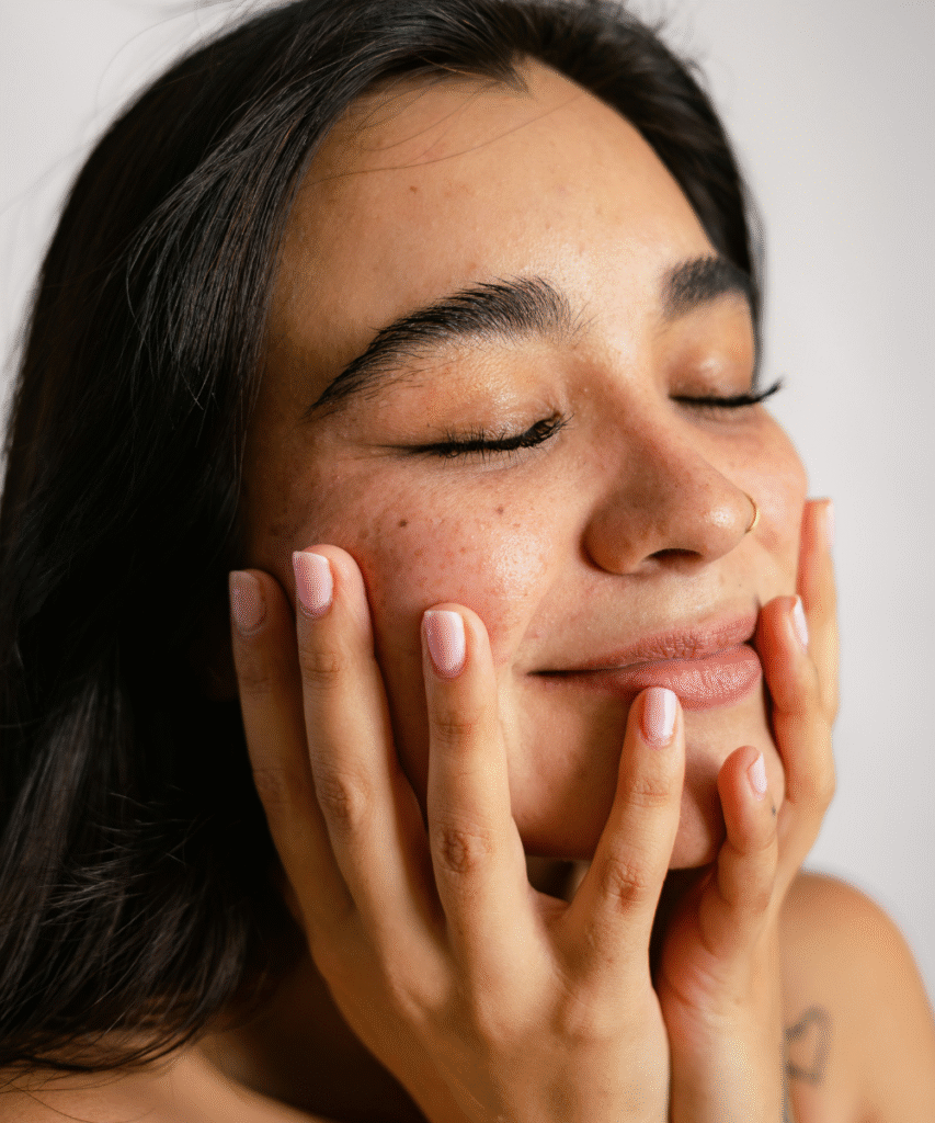 derma peel chemical peel