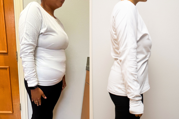 medical weight loss dallas